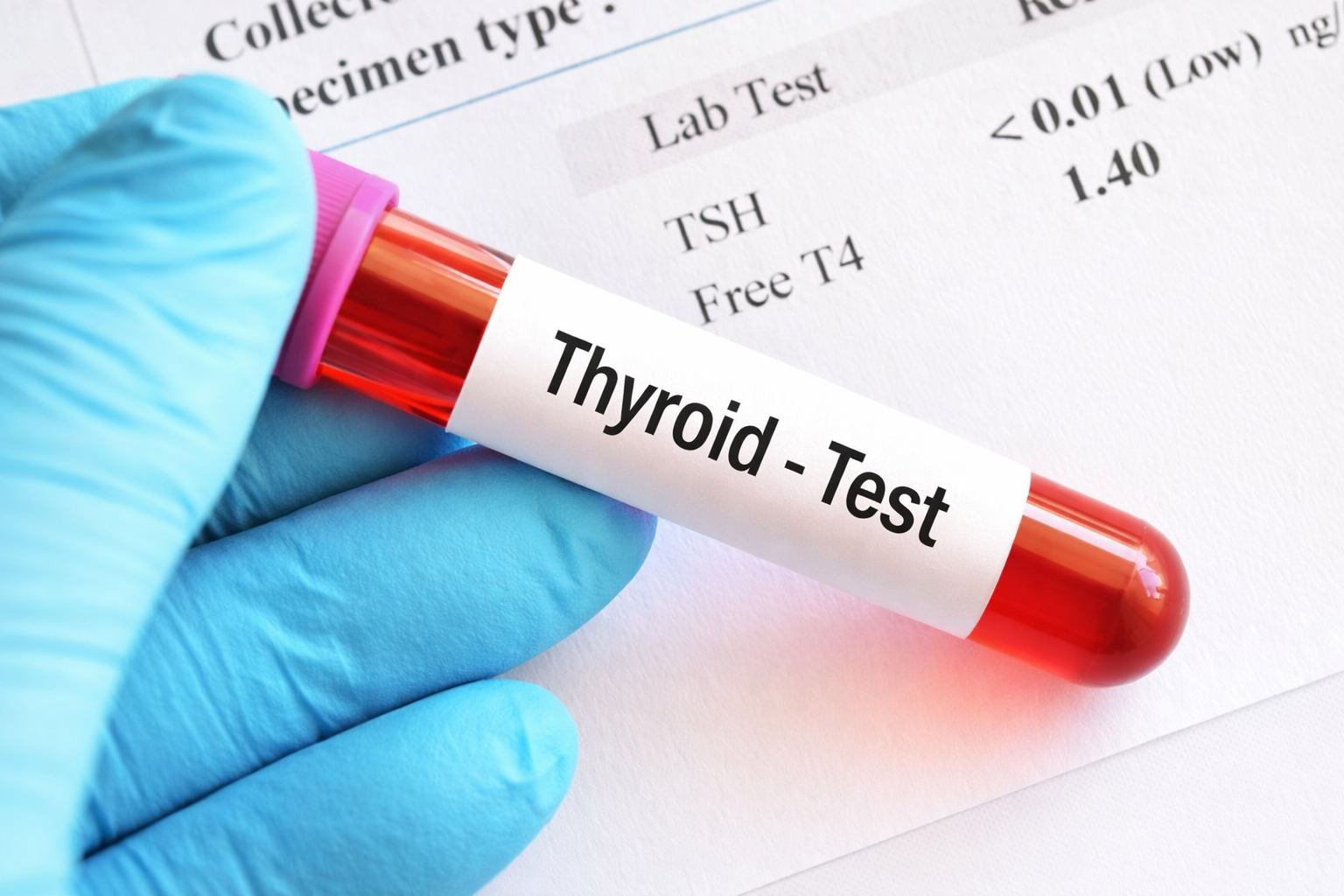 Zob Analizi Hansılardır? Necə Verilir?